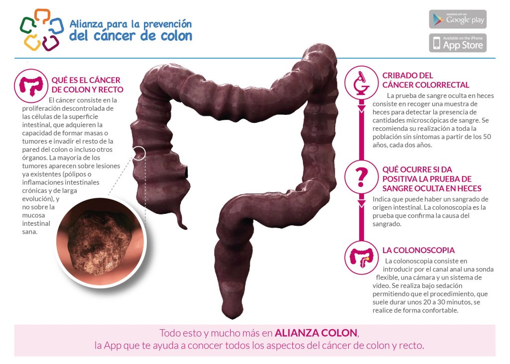 Cancer de colon ultimos dias Cancer de colon bioneuroemocion - terapiesicoaching.ro